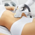 The Pros and Cons of Laser Hair Removal