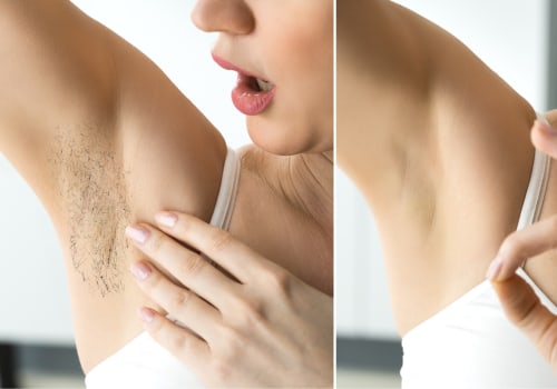 The Risks of Using an IPL/RF/Laser Combination Device for Hair Removal
