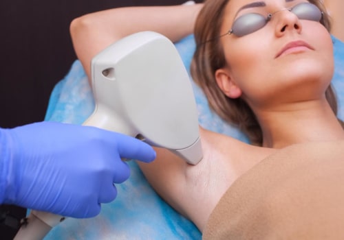 Is Laser Hair Removal Embarrassing? Expert Advice on the Procedure