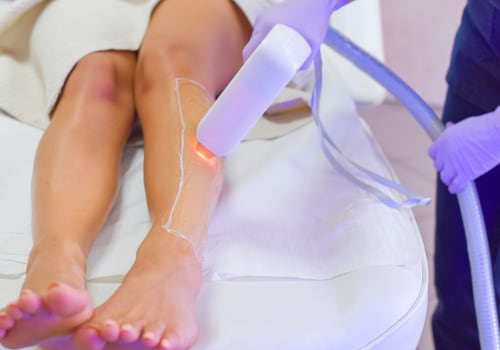 The Pros and Cons of IPL Hair Removal: An Expert's Perspective