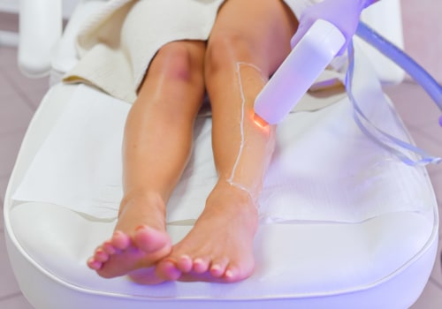 Is Laser Hair Removal Safe? - An Expert's Perspective